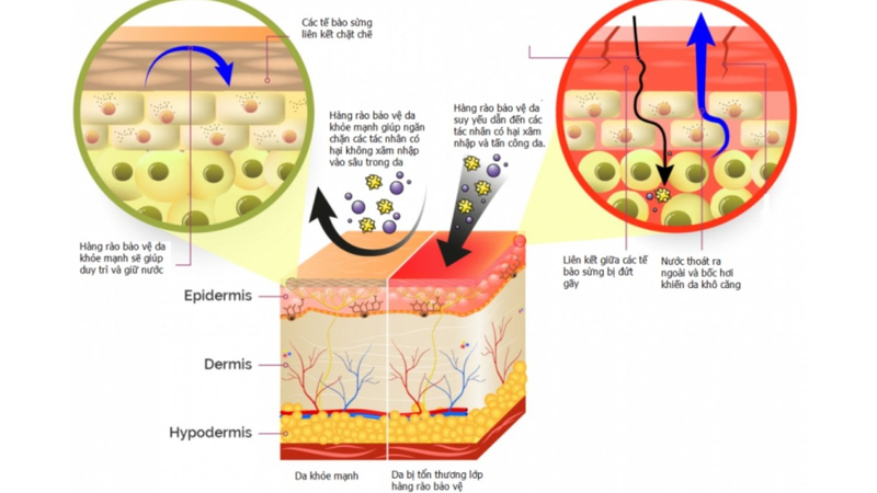 Hàng rào bảo vệ da là gì? Cách chăm sóc hàng rào bảo vệ da 1