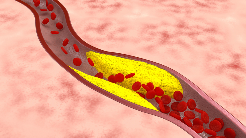 HDL và LDL là gì? Phân biệt rõ ràng hai loại cholesterol trong máu 2