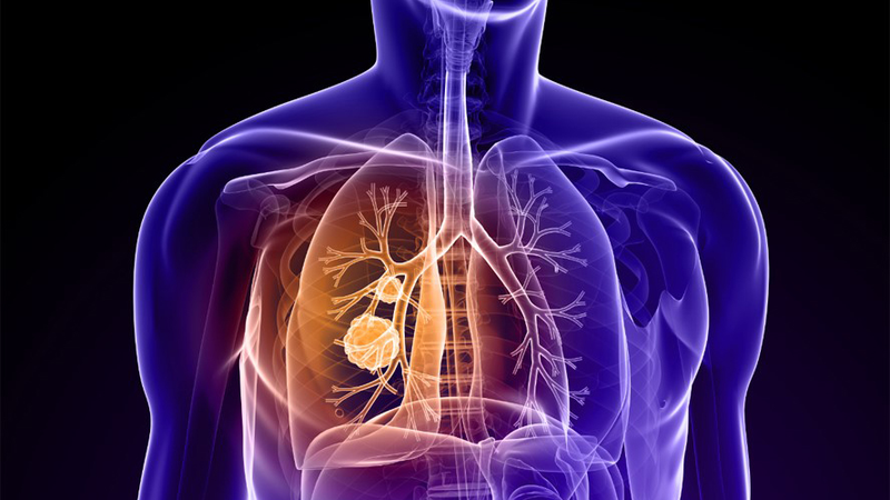 Hệ hô hấp là gì? Các bệnh về hệ hô hấp thường gặp 1