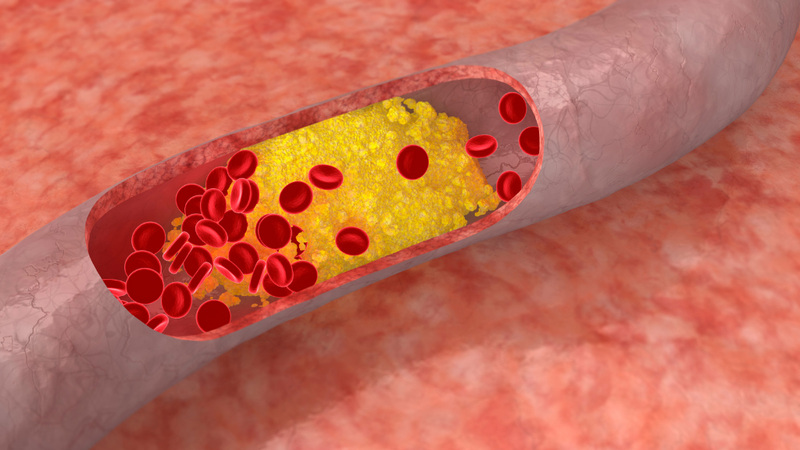 Hiểu rõ về Cholesterol toàn phần: Mảnh ghép quan trọng trong bức tranh sức khỏe 2