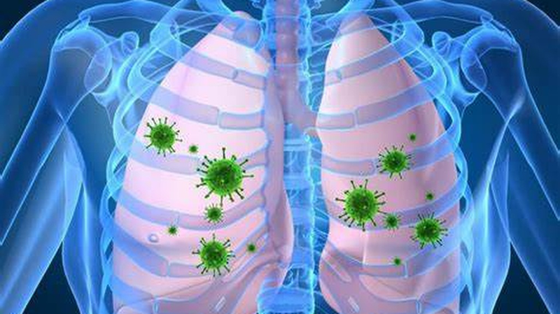 Hiểu rõ về xơ rải rác 2 phổi: Nguyên nhân, triệu chứng và hướng điều trị 3