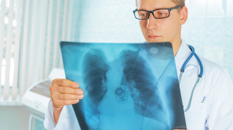 Hiểu rõ về xơ rải rác 2 phổi: Nguyên nhân, triệu chứng và hướng điều trị 4