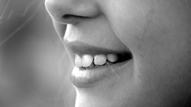 Hình ảnh răng hô nhẹ​ cùng giải pháp cải thiện 1