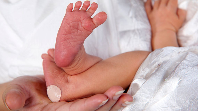 Hình ảnh trẻ bị suy giáp bẩm sinh sẽ như thế nào 3