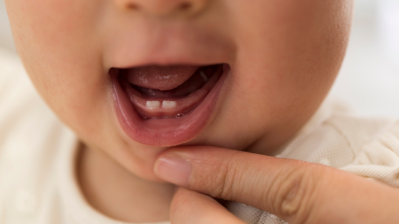 Hình ảnh trẻ đi tướt mọc răng và cách chăm sóc cha mẹ nên biết rõ1