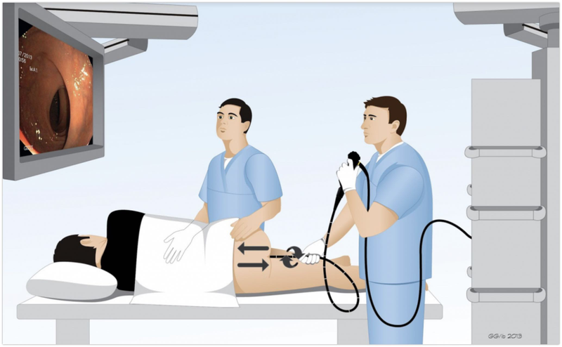 Ứng dụng và cách chụp hình ảnh viêm đại tràng 3