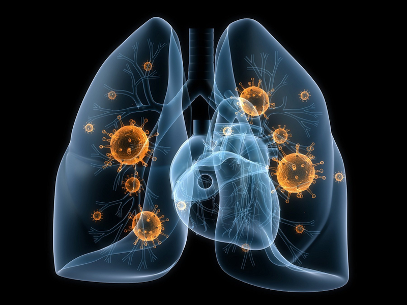 Hình thể ngoài, cấu trúc của nhu mô phổi và các bệnh về phổi thường gặp 4