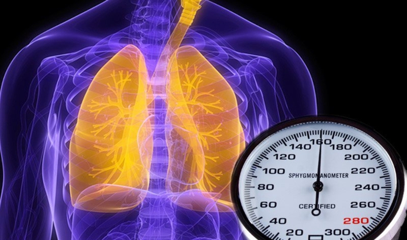 Hở van động mạch phổi: Nguyên nhân, triệu chứng, cách chẩn đoán và điều trị 3