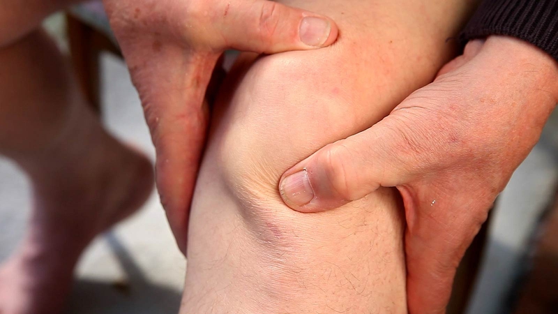 Hội chứng đau Patellofemoral: Triệu chứng và cách điều trị 2