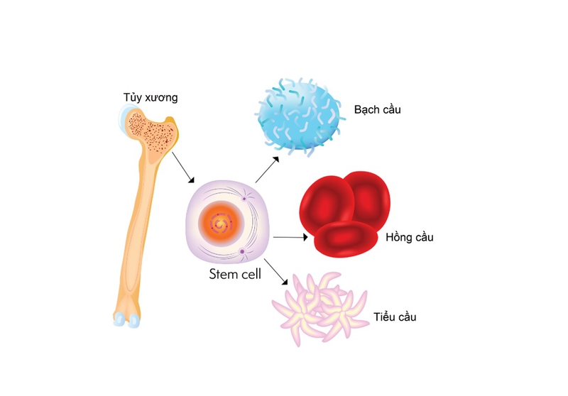 Hội chứng rối loạn sinh tủy (MDS): Nguyên nhân, triệu chứng, cách điều trị 1