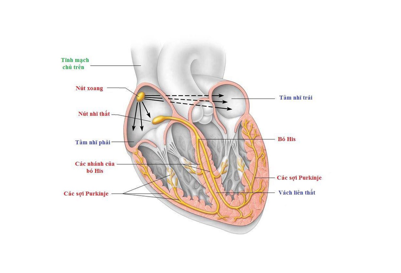 Hội chứng suy nút xoang: Nguyên nhân, triệu chứng, cách điều trị 1