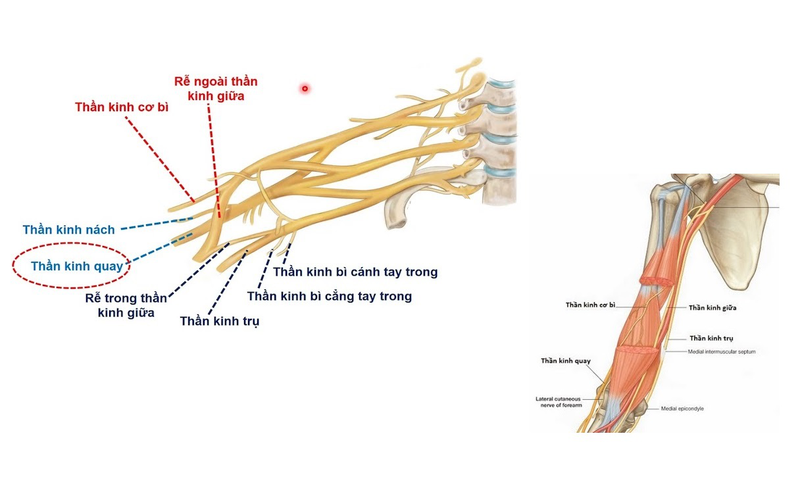 Hội chứng thần kinh gian cốt sau là gì? Có chữa được không 1