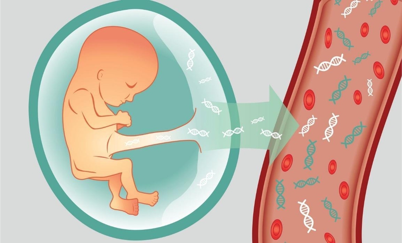 Tổng quan về hội chứng trisomy 13 1