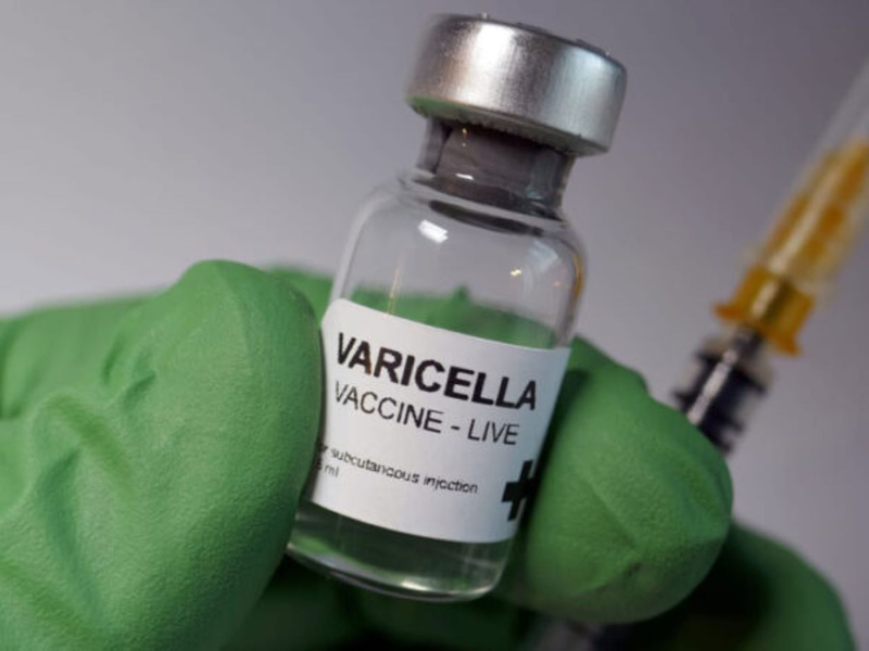 Hỏi đáp: Vắc xin thủy đậu có trong Tiêm chủng mở rộng không? 1