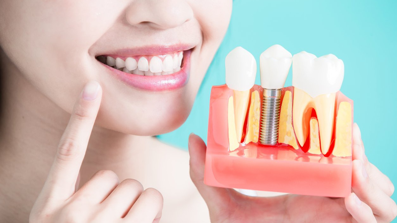 Hối hận khi trồng implant giá rẻ 2