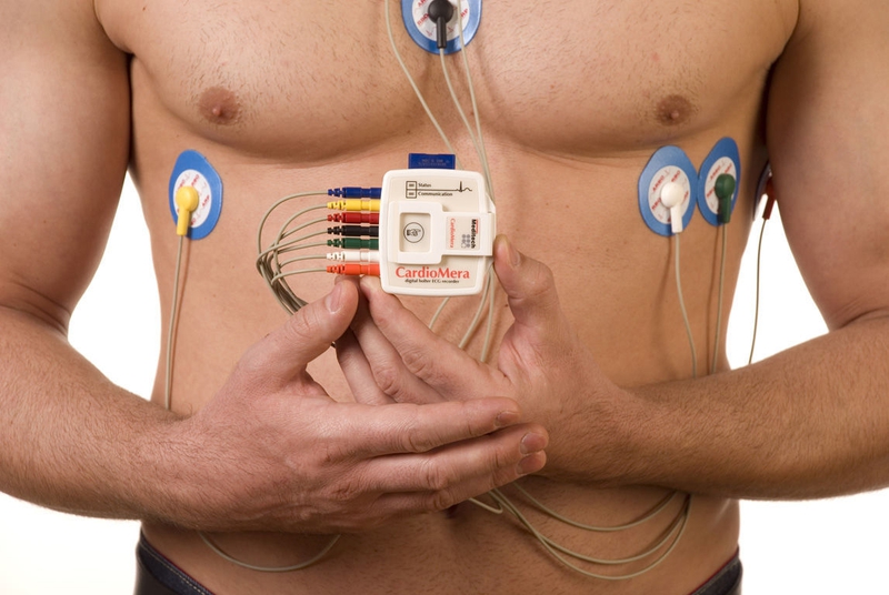 Holter điện tâm đồ là một công cụ quan trọng trong việc xác định bệnh liên quan đến tim