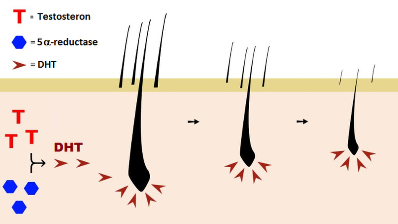 Hormone DHT là gì? Những điều cần biết về DHT và rụng tóc 2