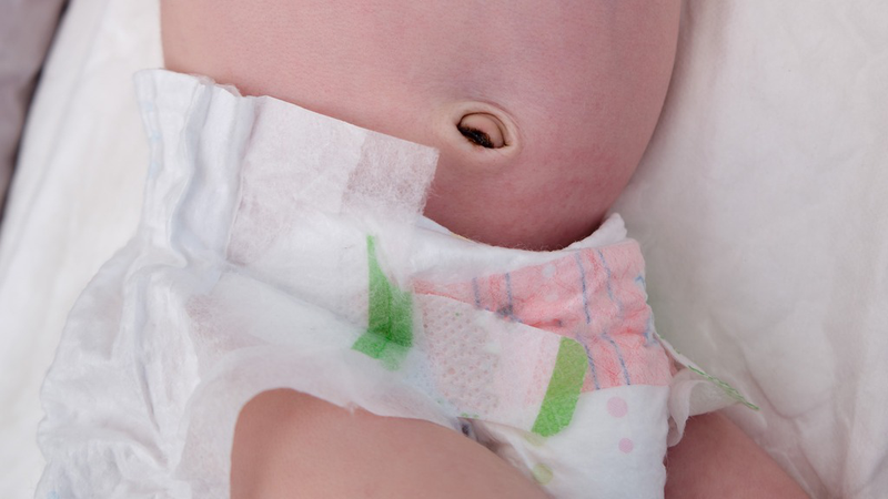 Hướng dẫn cách chăm sóc rốn trẻ sơ sinh đúng cách và an toàn 3