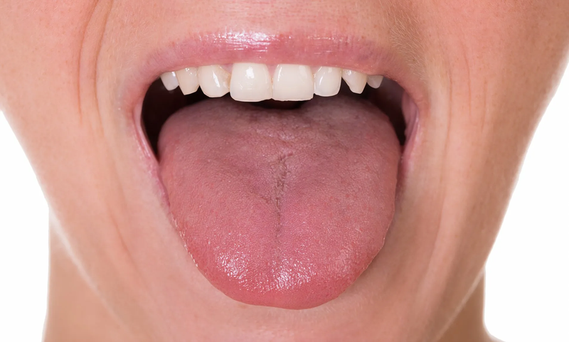 Hướng dẫn cách làm sạch lưỡi giúp khoang miệng luôn thơm mát 1