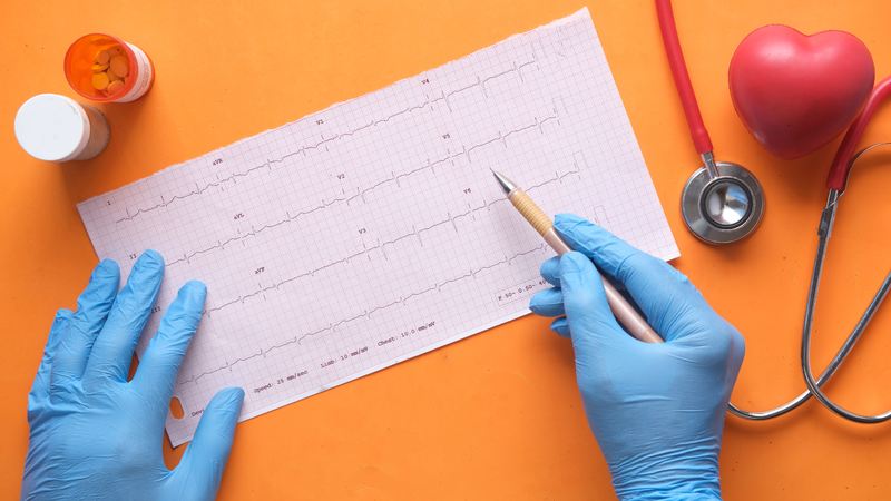 Hướng dẫn đọc ECG: Phân tích cấu trúc, nhịp tim và rối loạn nhịp 1