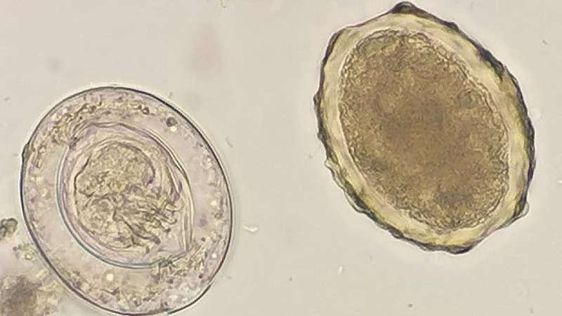 Hymenolepis nana: Triệu chứng nhiễm trùng và cách phòng tránh  1