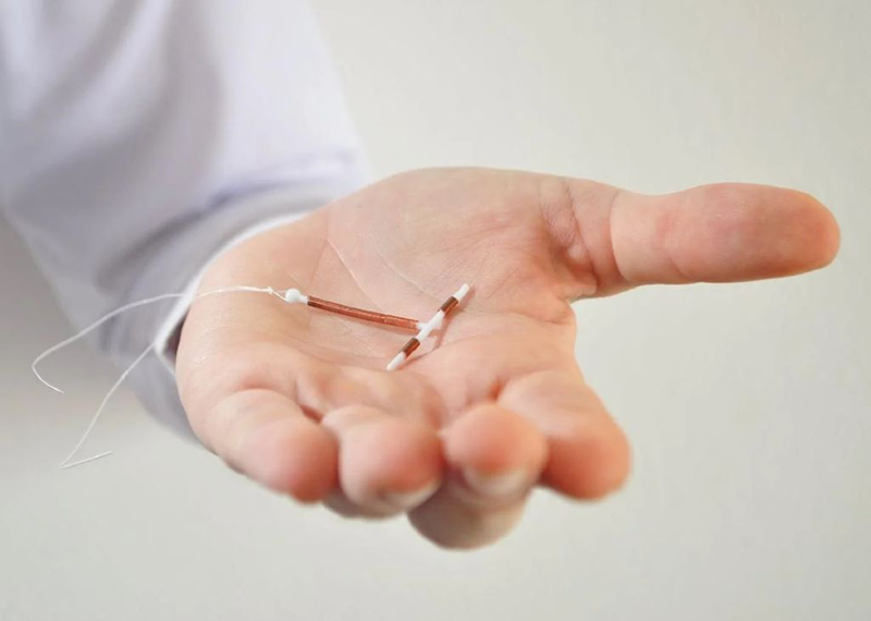 Iud là gì? Cơ chế hoạt động của vòng tránh thai và thời điểm đặt IUD mà chị em nên biết 1