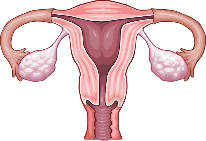 Iud là gì? Cơ chế hoạt động của vòng tránh thai và thời điểm đặt IUD mà chị em nên biết 4