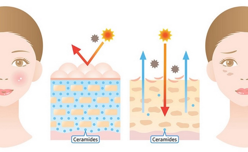 Ceramide là một thành phần quan trọng của làn da