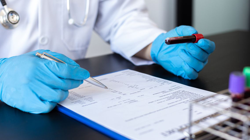 Một số trường hợp bác sĩ sẽ chỉ định thực hiện xét nghiệm máu tổng quát