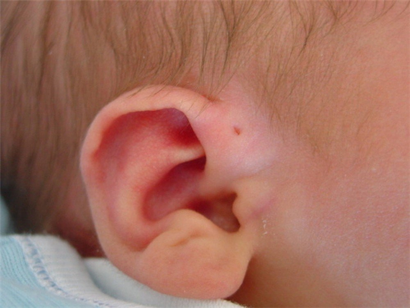 Khám tai: 3 vị trí quan trọng cảnh báo bệnh lý nguy hiểm về tai 3