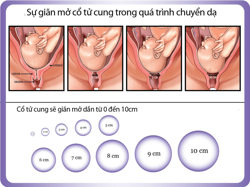 Tìm hiểu khám xóa mở cổ tử cung là gì?