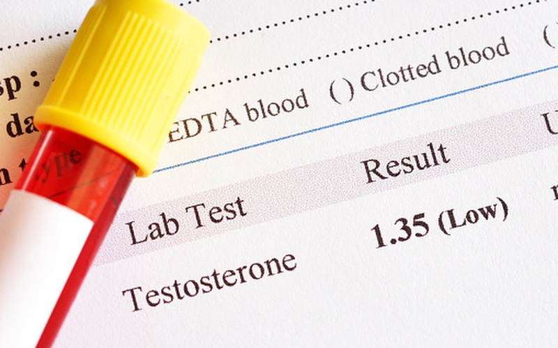 Khi nào cần thực hiện xét nghiệm testosterone? 4