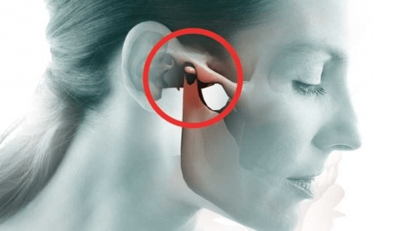 Khi nhai có tiếng kêu trong tai là bệnh gì? 1