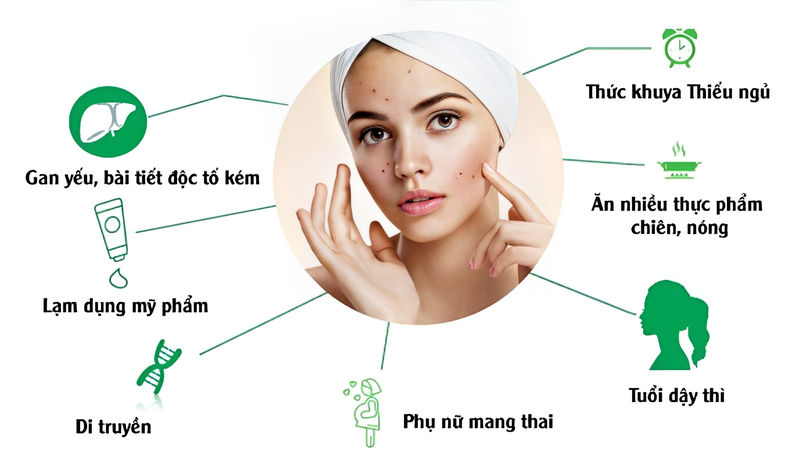 Không nặn mụn có tự hết không? 1