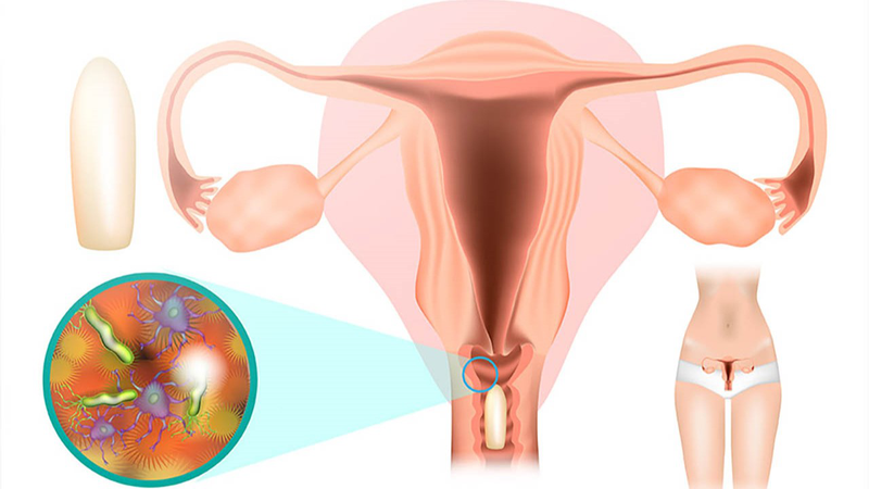 Lá trầu không: Vị thuốc có nhiều tác dụng 6.jpg