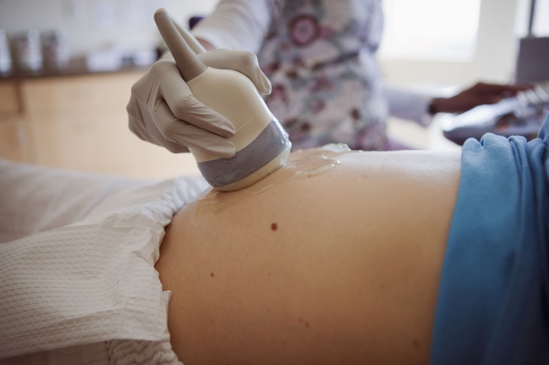 Làm IVF có cần chụp tử cung vòi trứng không?2