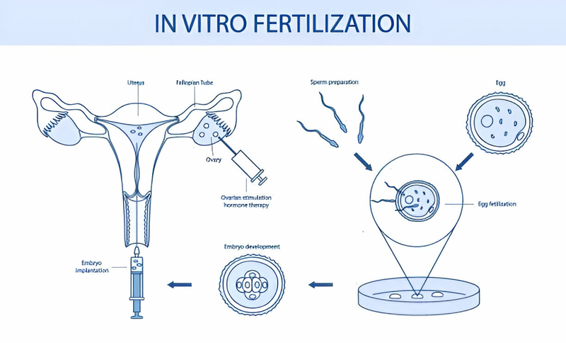 Làm IVF hết bao nhiêu tiền?-1