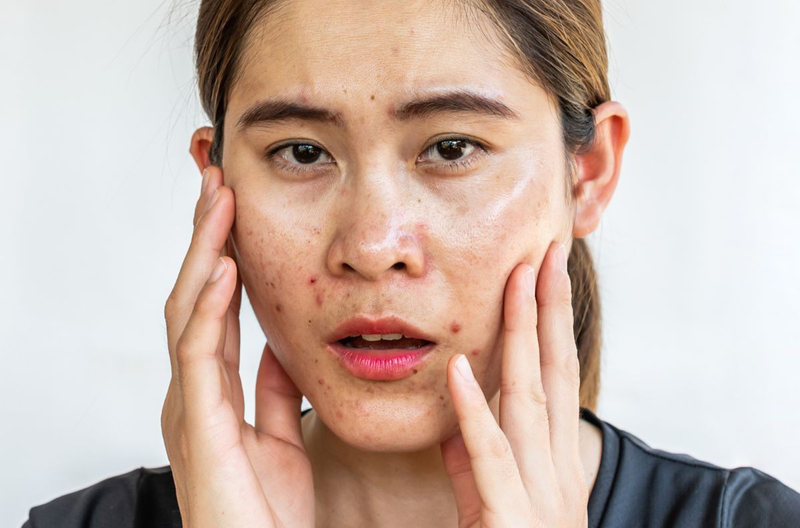 Làm sạch sâu da mặt có lợi ích gì? Cách làm sạch sâu da mặt 1