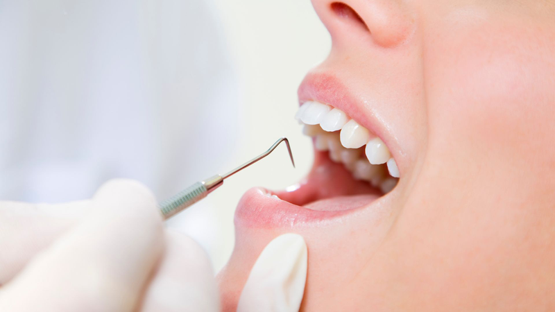 Lấy cao răng có đau không? Sự thật và lời khuyên từ chuyên gia nha khoa 1