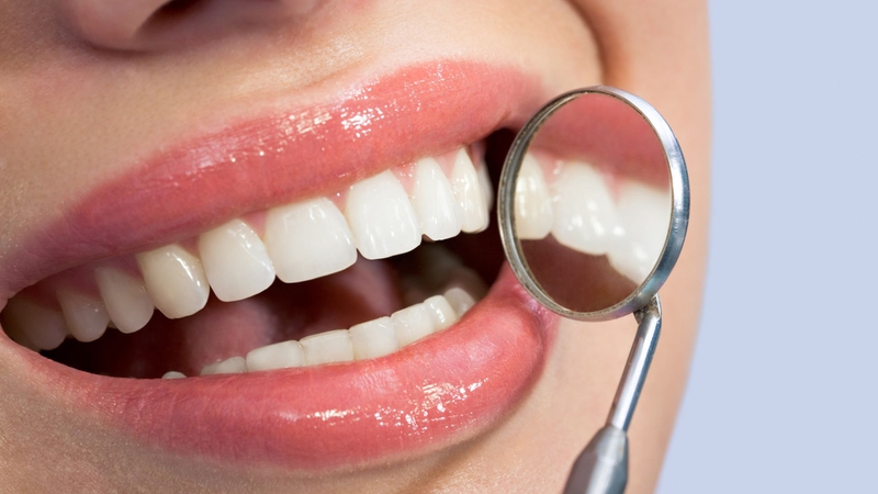 Lấy cao răng có đau không? Sự thật và lời khuyên từ chuyên gia nha khoa 3