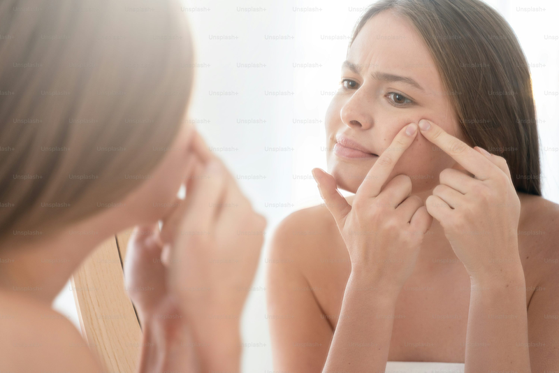Không nên nặn mụn bằng móng tay vì dễ gây trầy xước, tăng nguy cơ viêm nhiễm và nổi mụn nhiều hơn