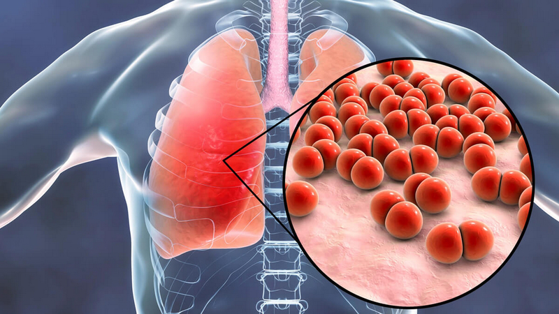 Liều dùng augmentin cho trẻ em cha mẹ nên biết để đảm bảo an toàn, hiệu quả điều trị 1