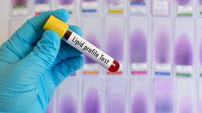Lipid toàn phần​ là gì? Các yếu tố ảnh hưởng đến kết quả xét nghiệm lipid toàn phần 2