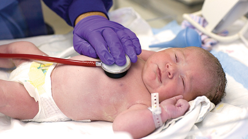 Loạn sản phổi ở trẻ sơ sinh: Nguyên nhân, triệu chứng và cách điều trị 3