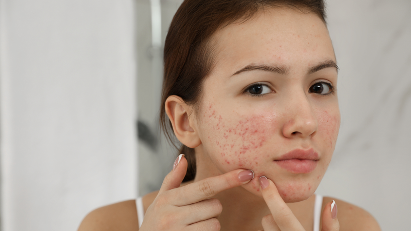Lợi ích của dầu hạt lưu ly với làn da phụ nữ 4