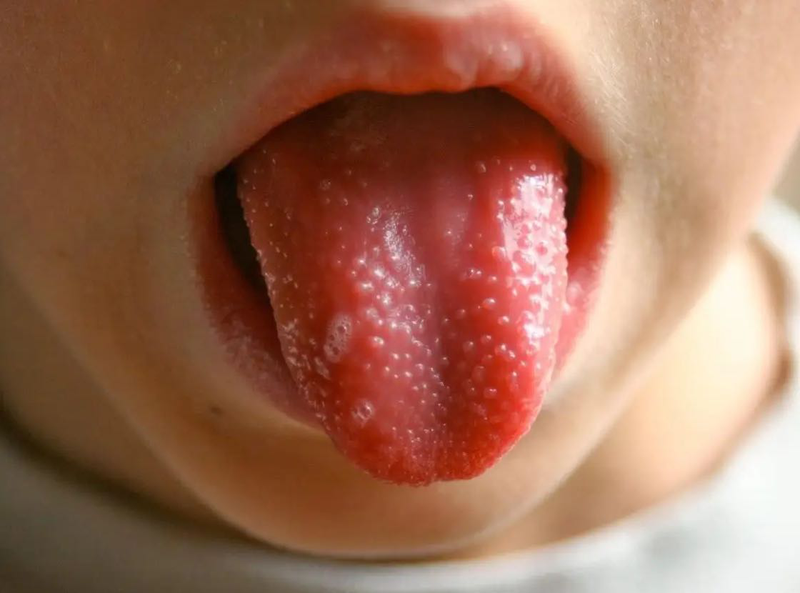 Cấu tạo của lưỡi là gì? Chức năng của lưỡi 3