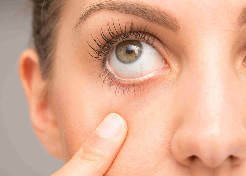 Mách bạn cách đơn giải giúp cải thiện tình trạng khô mỏi mắt1