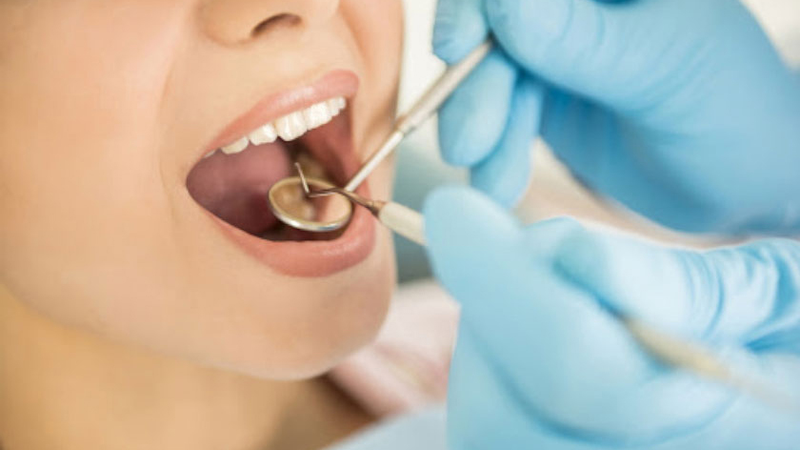 Mầm răng là gì? Thiếu mầm răng vĩnh viễn phải làm sao? 1