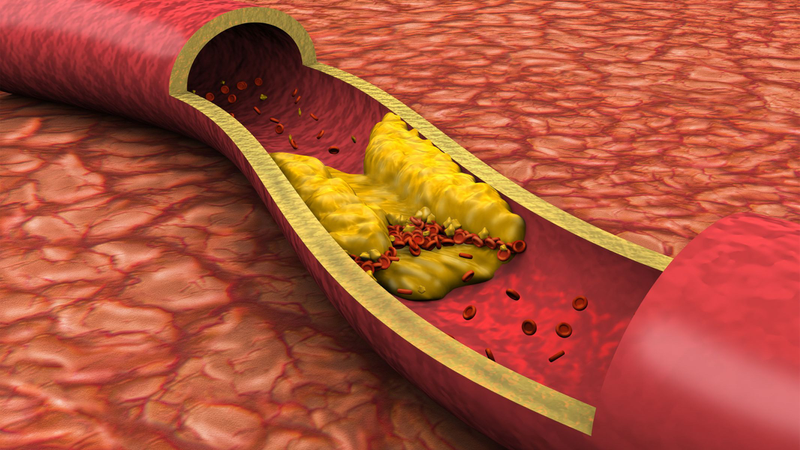 Mật ong giúp giảm cholesterol xấu (LDL), hạ triglyceride và tăng cholesterol tốt (HDL), từ đó giảm nguy cơ xơ vữa động mạch
