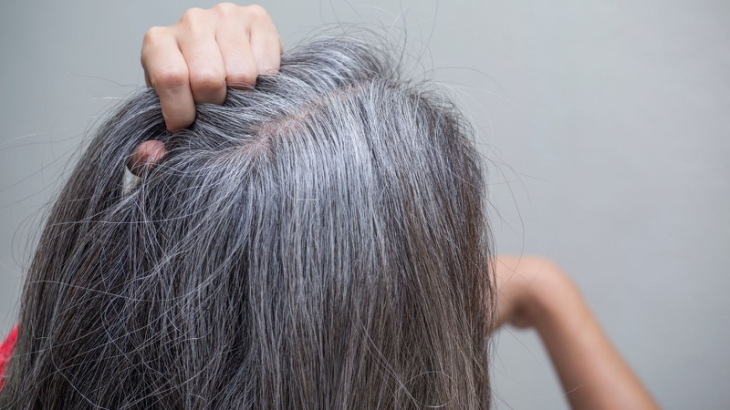 Máu xấu tóc bạc là quan niệm đúng hay sai? Nguyên nhân tóc bạc sớm 2